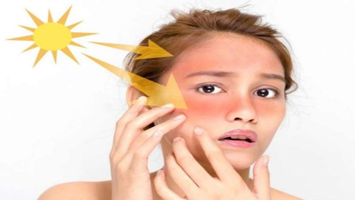 Here are some simple home remedies to cut skin tan in hot weather