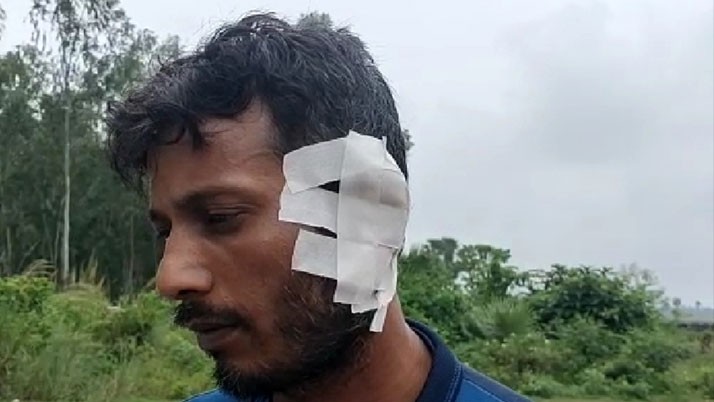 Neighbor's whole ear was bitten by a drug addicted youth at guskara