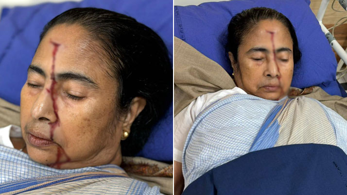 Critically injured Chief Minister Mamata Banerjee, admitted to SSKM