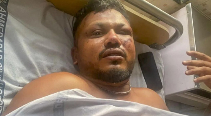 Air Indian plane crash only survivor life